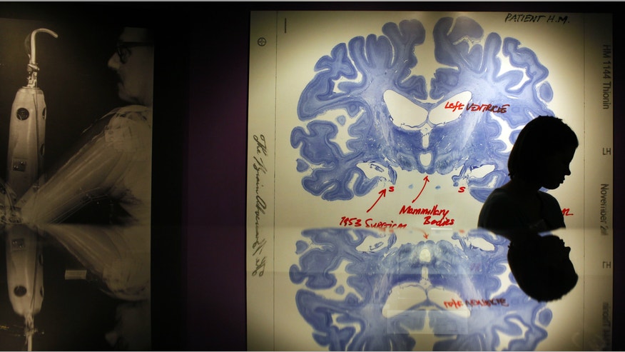 Patient H.M. Brain_Reuters.jpg